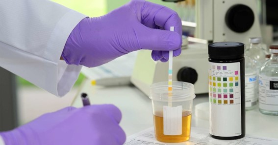 An Overview of Different Types of Drug Tests